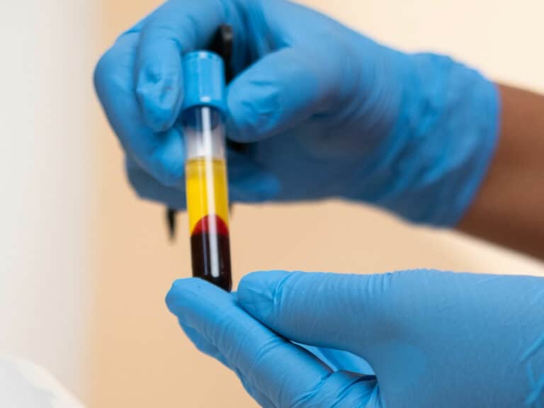 Plasma rico en plaquetas con factores de crecimiento